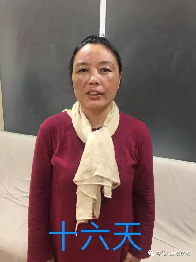 调理车祸案例 调理车祸案例