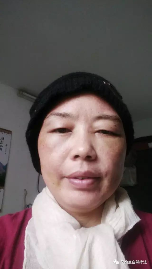 调理车祸案例 调理车祸案例