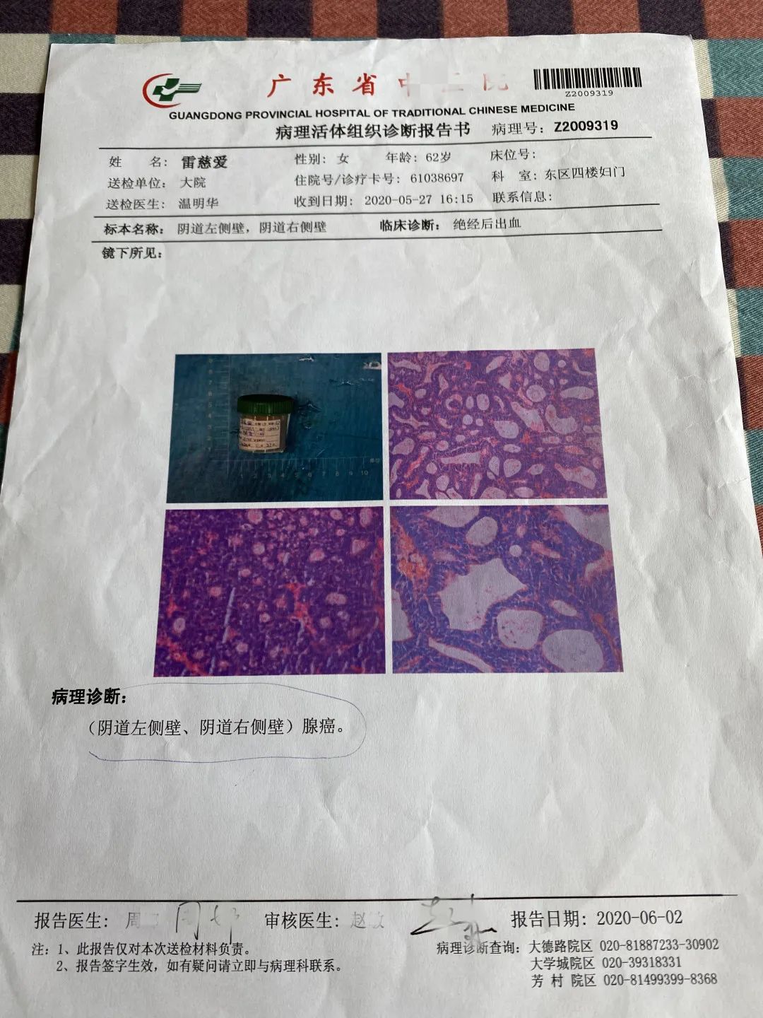 原始点调理宫颈腺癌及全身多处疼痛案例 原始点调理宫颈腺癌及全身多处疼痛案例