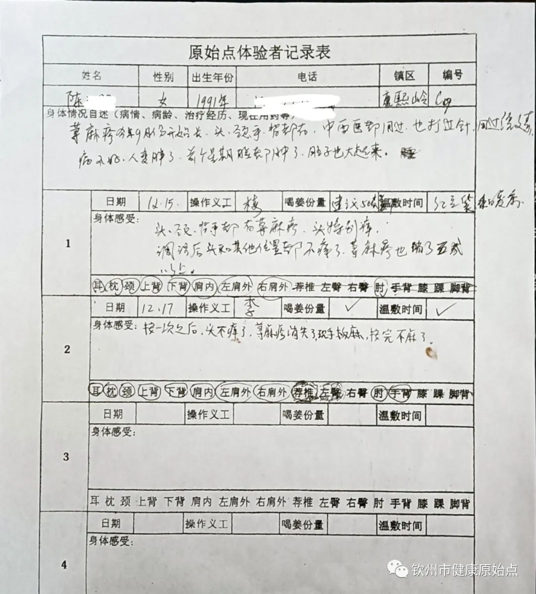 荨麻疹、手麻案例