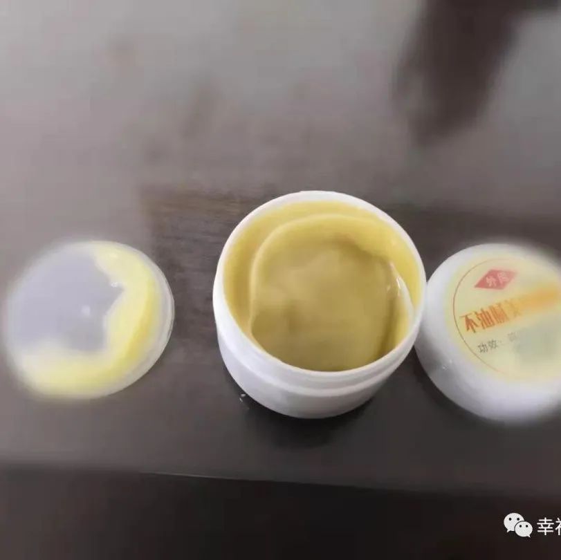 姜膏美容，搓姜粉缓解烫伤案例-原始点全球同学网
