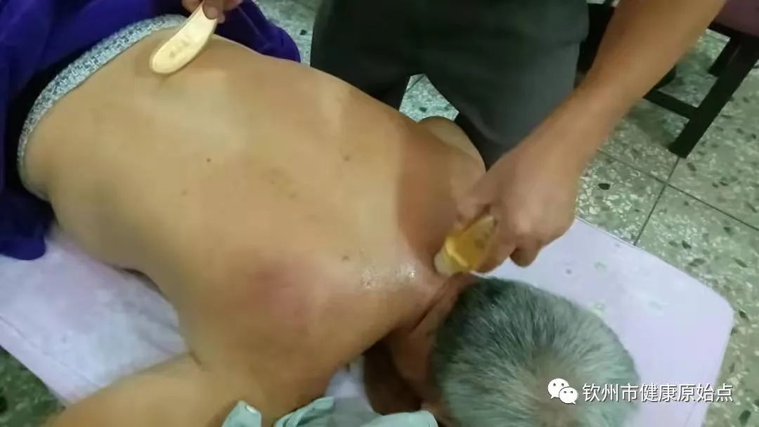 睡不好、颈椎增生、严重肩周炎、上胸疼痛案例 睡不好、颈椎增生、严重肩周炎、上胸疼痛案例