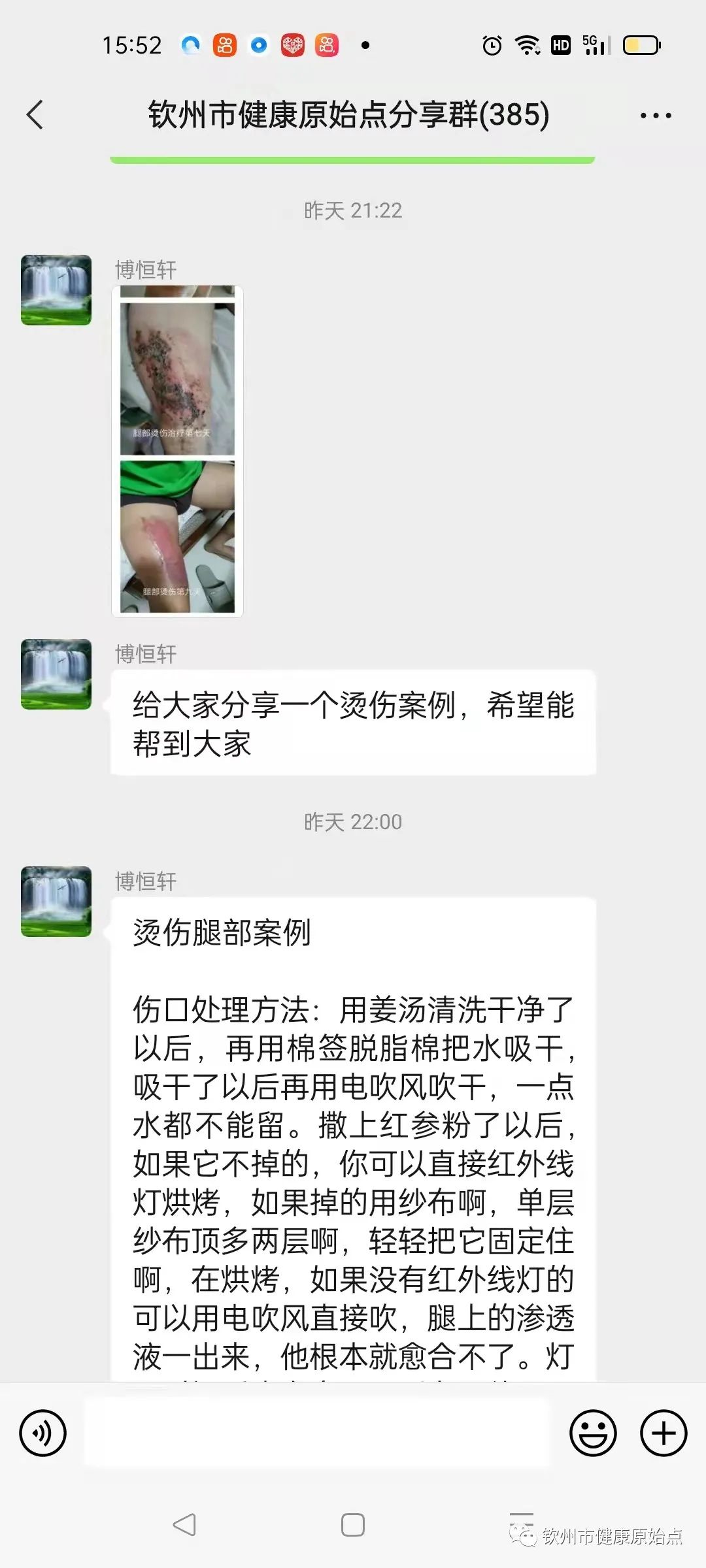 腿部烫伤,经常觉得累、老想睡觉、手脚冰凉、大便不成型案例 腿部烫伤,经常觉得累、老想睡觉、手脚冰凉、大便不成型案例