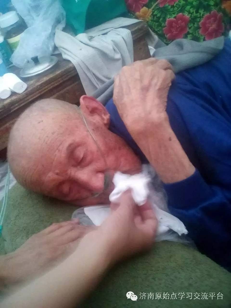 孝顺儿媳用原始点帮91岁肠梗阻病危公公恢复健康!现在的社会有几人能做到? 孝顺儿媳用原始点帮91岁肠梗阻病危公公恢复健康!现在的社会有几人能做到?