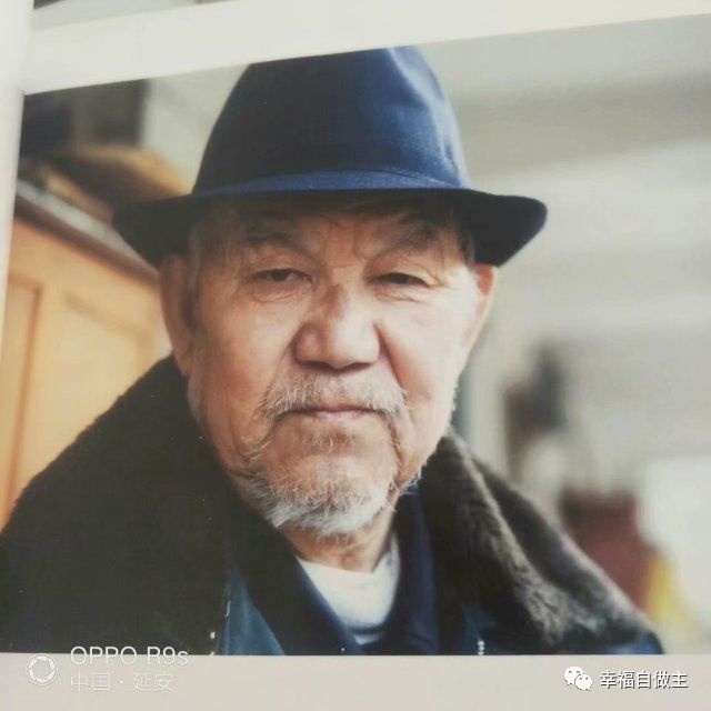 三叉神经痛案例