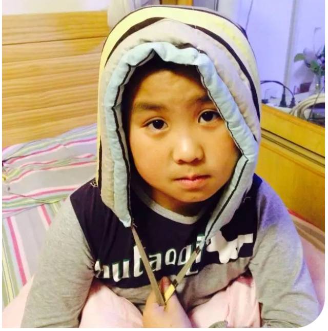 十几年头痛的案例 十几年头痛的案例