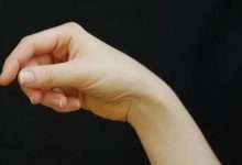 案例分享:原始点调理桡骨骨折、错位,10天见效的案例-原始点全球同学网