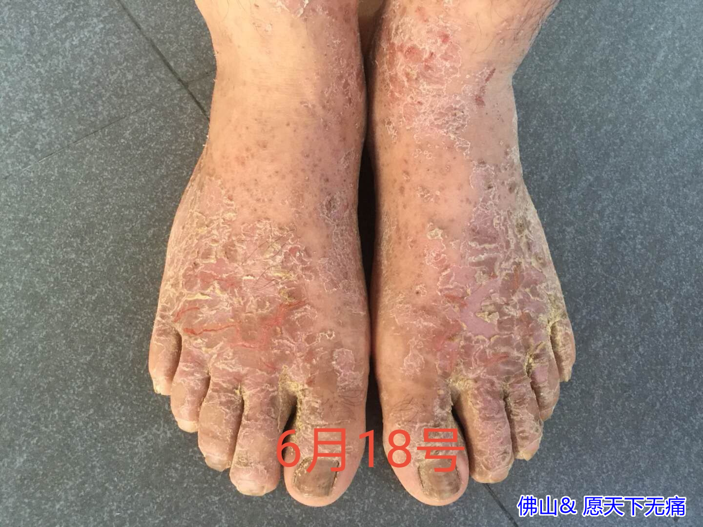 原始点调理身体多处症状效果快 - 身体  五脏六腑 - 佛山市愿天下无痛健康管理服务有限公司