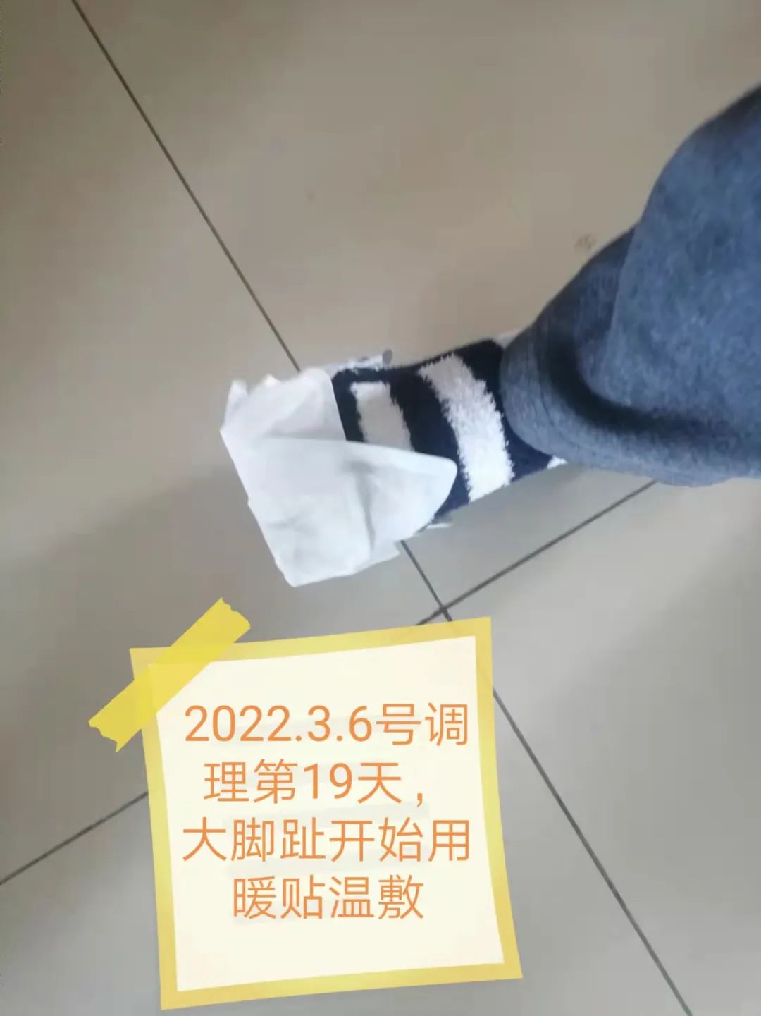 糖尿病案例 糖尿病案例