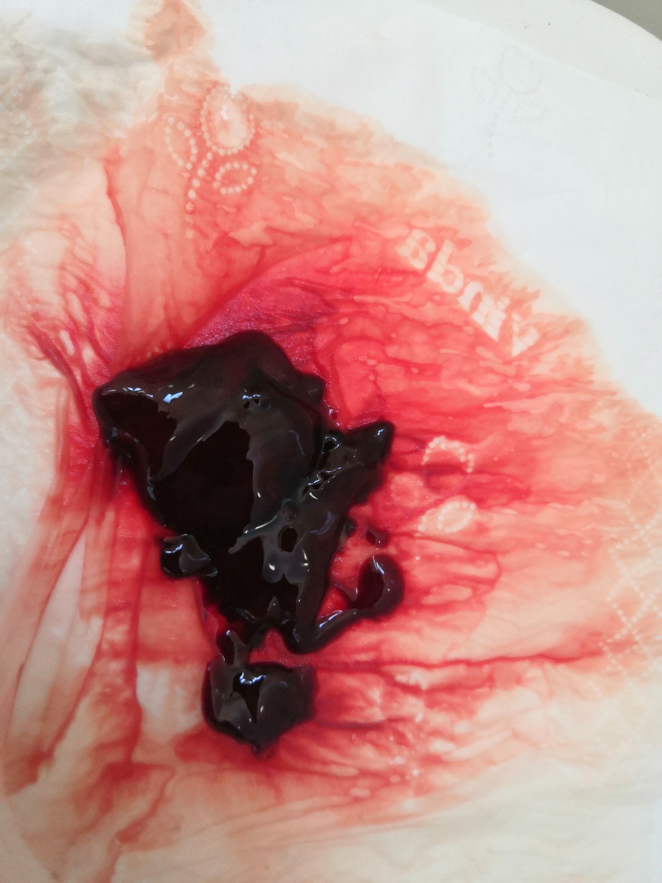 原始点调理胎死腹中案例 - 妇产   - 佛山市愿天下无痛健康管理服务有限公司