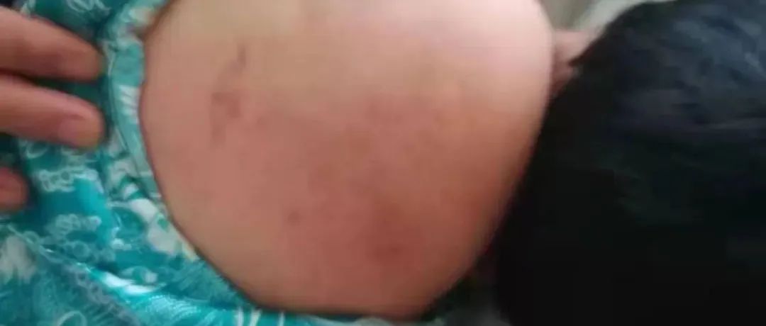 案例分享：原始点调理腿无力，无法下蹲以及消除“富贵包”的案例-原始点全球同学网