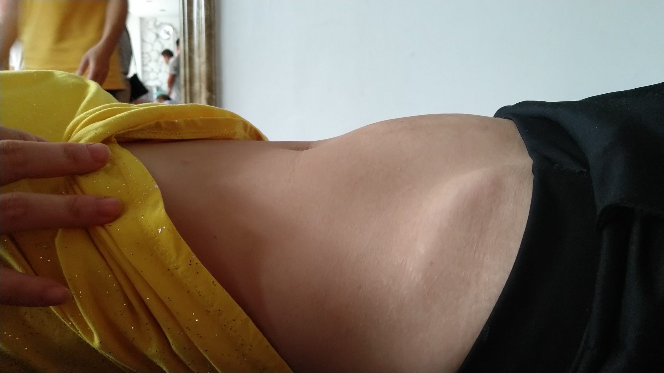 原始点调理卵巢囊肿案例 - 妇产   - 佛山市愿天下无痛健康管理服务有限公司