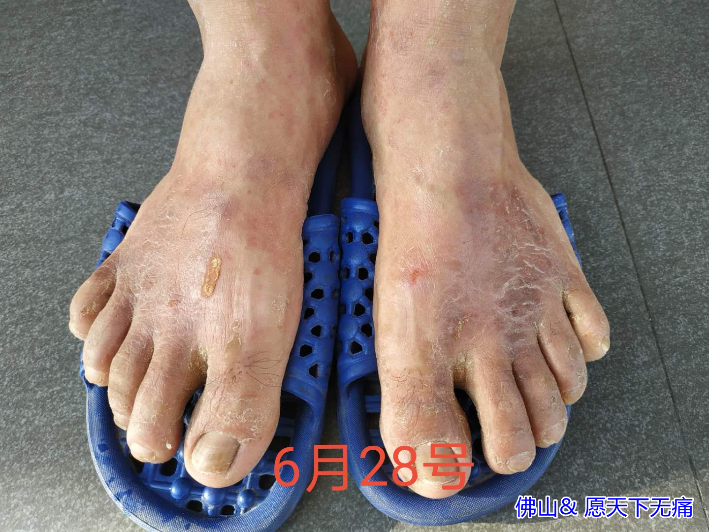 原始点调理身体多处症状效果快 - 身体  五脏六腑 - 佛山市愿天下无痛健康管理服务有限公司