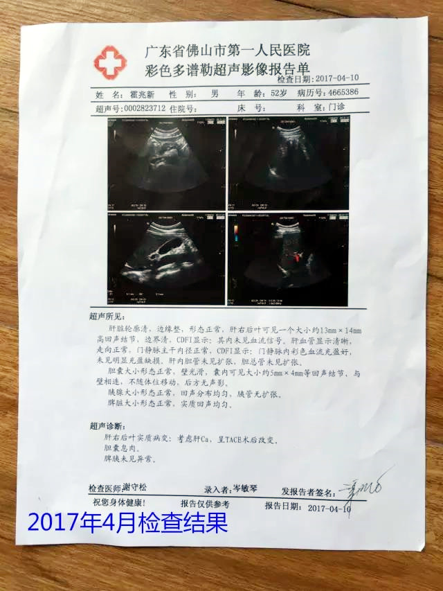 原始点调理肝癌三年后回访录：霍兆新 - 肝硬化  肝腹水  肝癌 - 佛山市愿天下无痛健康管理服务有限公司