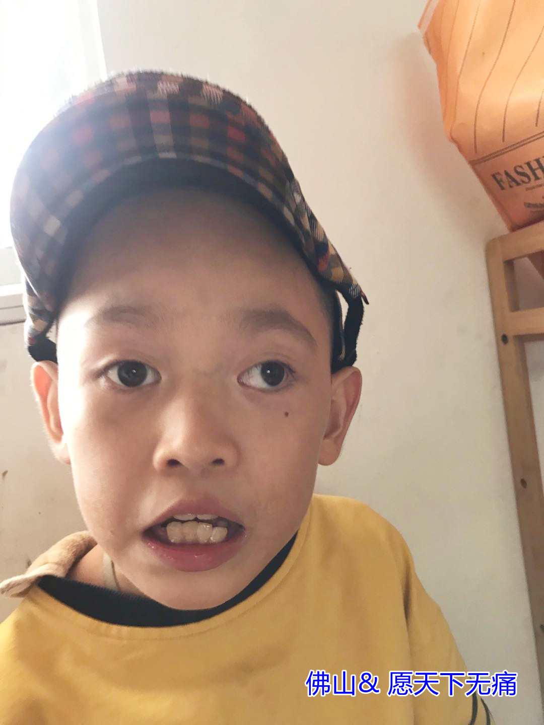 原始点调理幼儿脑外伤后遗症康复阶段性案例 - 幼儿  儿童 - 佛山市愿天下无痛健康管理服务有限公司