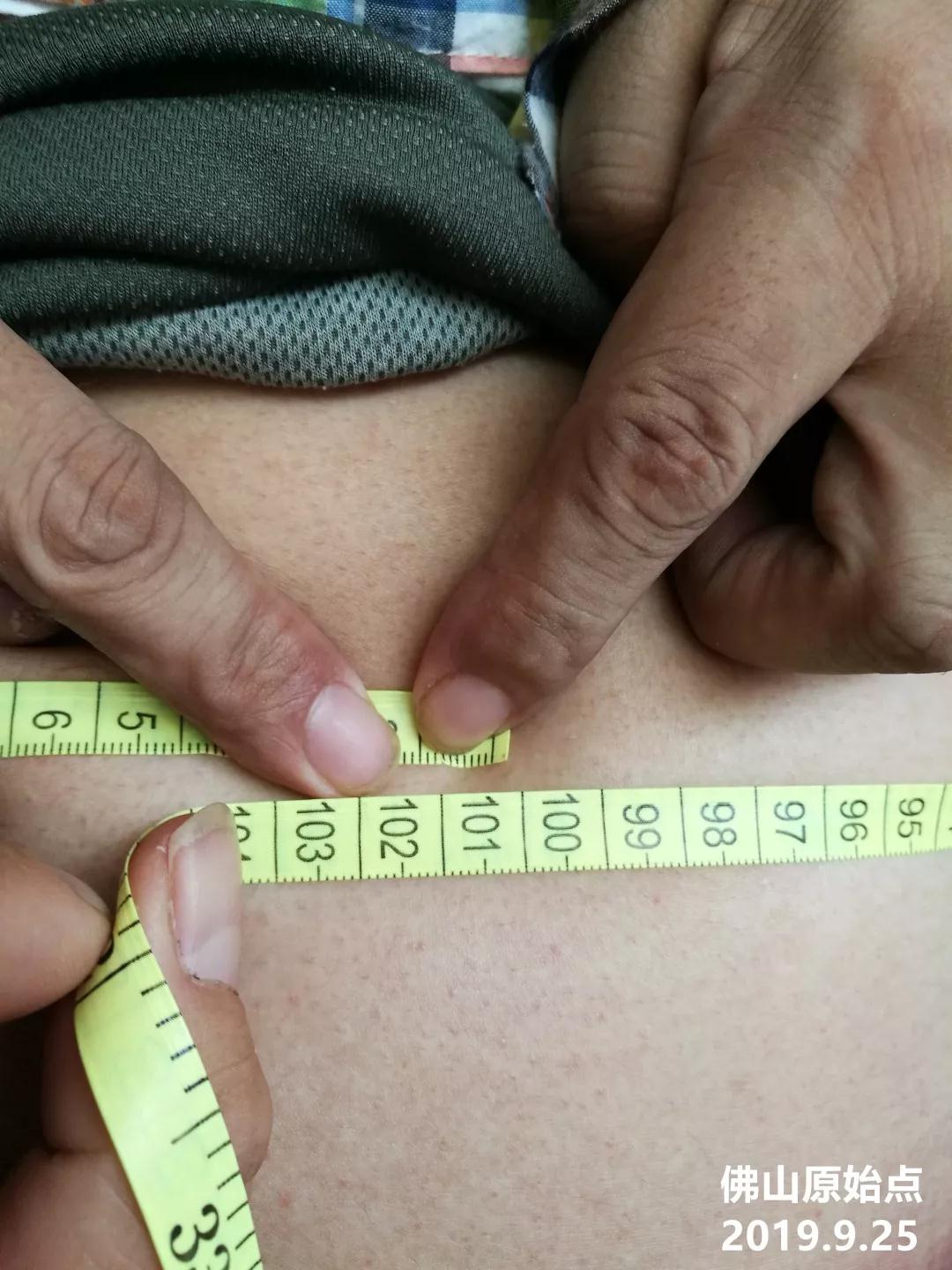 原始点调理胸腔积液及腹胀案例 - 身体 五脏六腑 - 佛山市愿天下无痛健康管理服务有限公司-原始点全球同学网