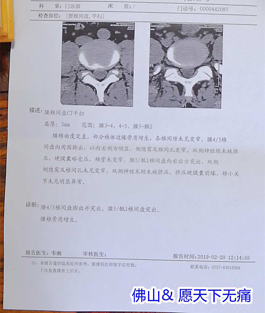 原始点调理疑似强直性脊柱炎案例 - 身体  五脏六腑 - 佛山市愿天下无痛健康管理服务有限公司