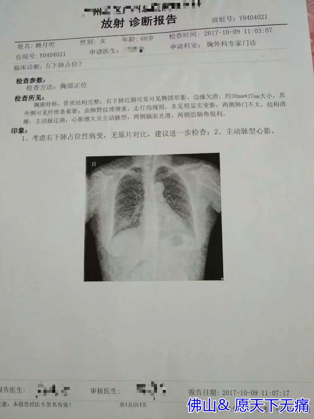 原始点调理肺部肿瘤案例 - 肺结核  肺腺癌  肺癌 - 佛山市愿天下无痛健康管理服务有限公司