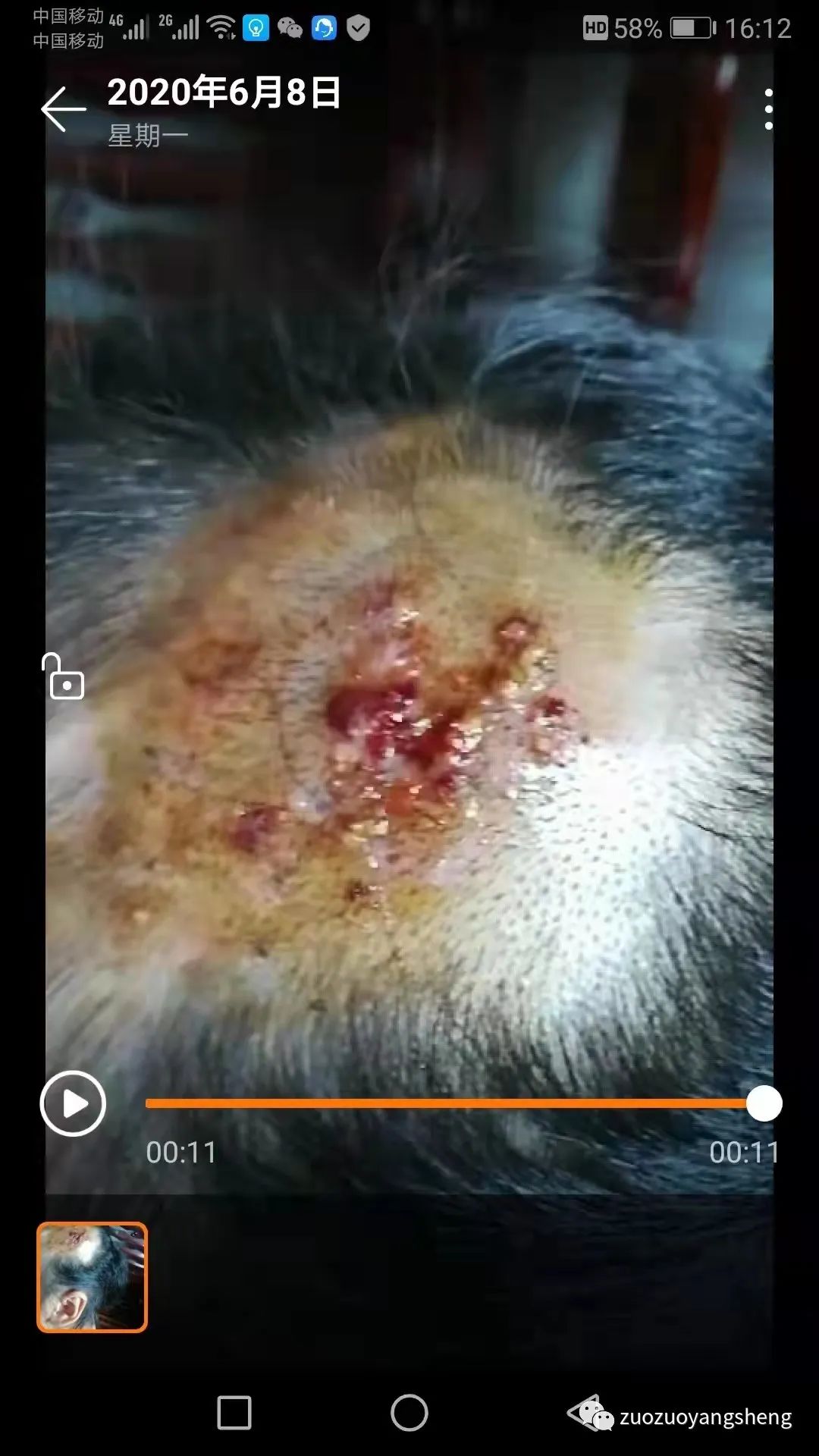 案例分享：原始点调理小孩毛囊炎反复发作的案例