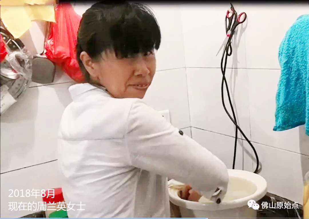 原始点调理脑血管瘤脑出血后遗症一年后回访录：周兰英 - 头颈  五官 - 佛山市愿天下无痛健康管理服务有限公司