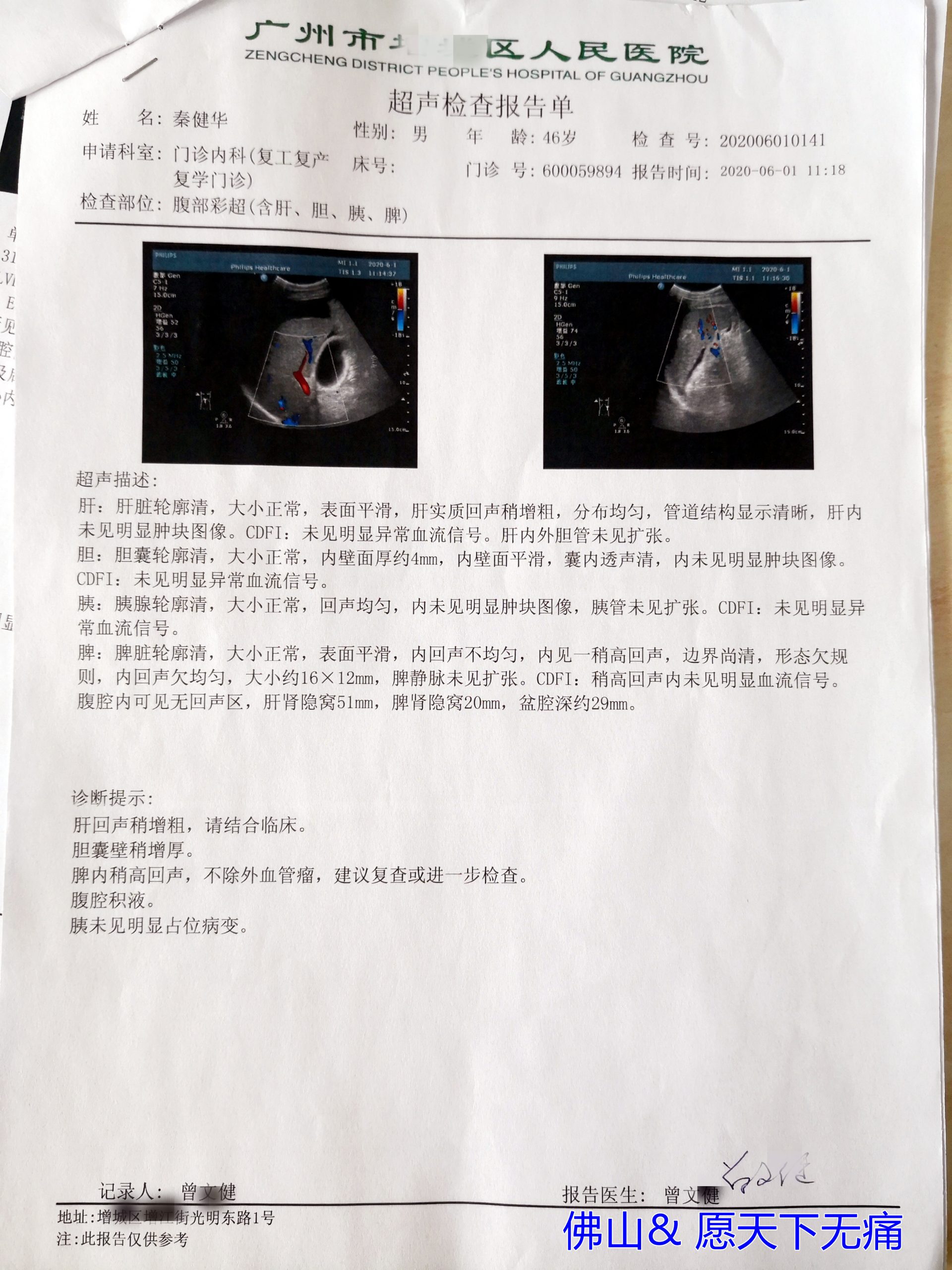 原始点调理肝脏问题案例 - 肝硬化  肝腹水  肝癌 - 佛山市愿天下无痛健康管理服务有限公司