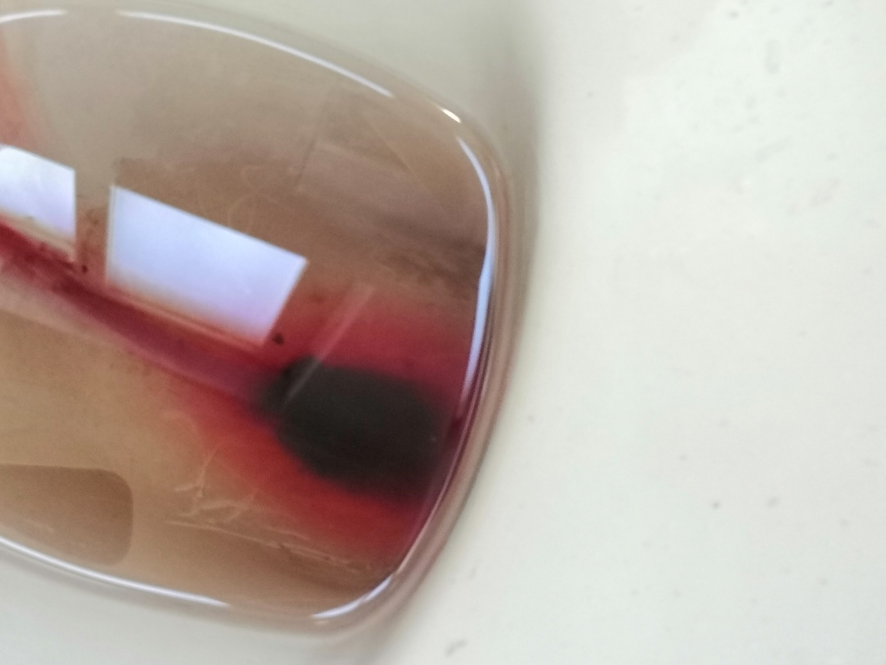 原始点调理胎死腹中案例 - 妇产   - 佛山市愿天下无痛健康管理服务有限公司