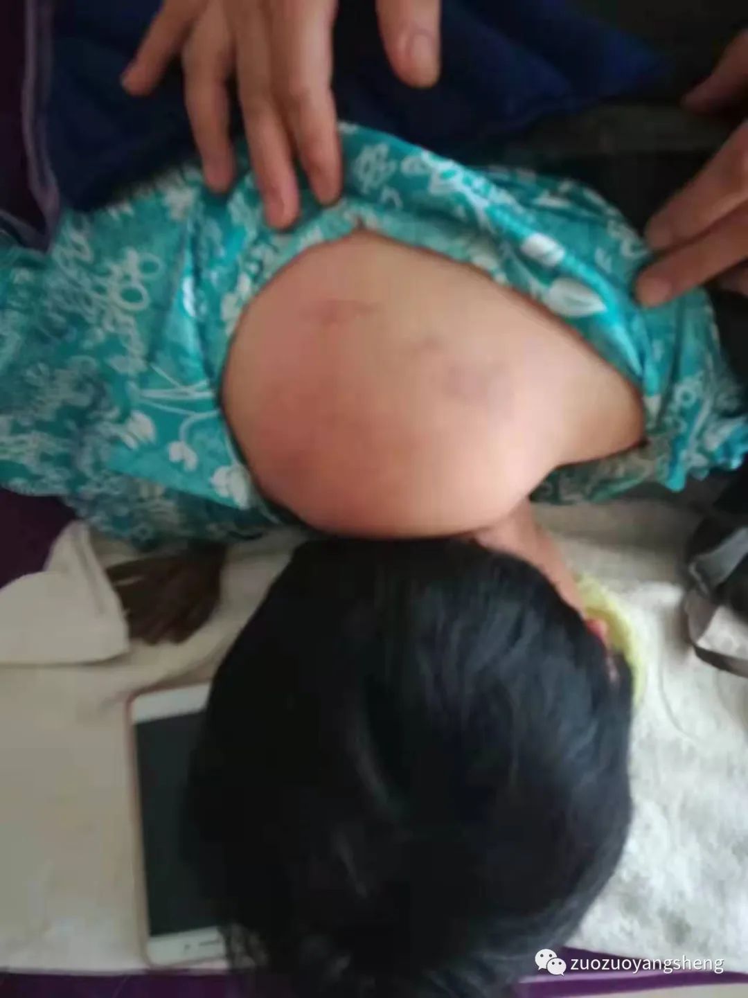 案例分享:原始点调理腿无力,无法下蹲以及消除“富贵包”的案例 案例分享:原始点调理腿无力,无法下蹲以及消除“富贵包”的案例