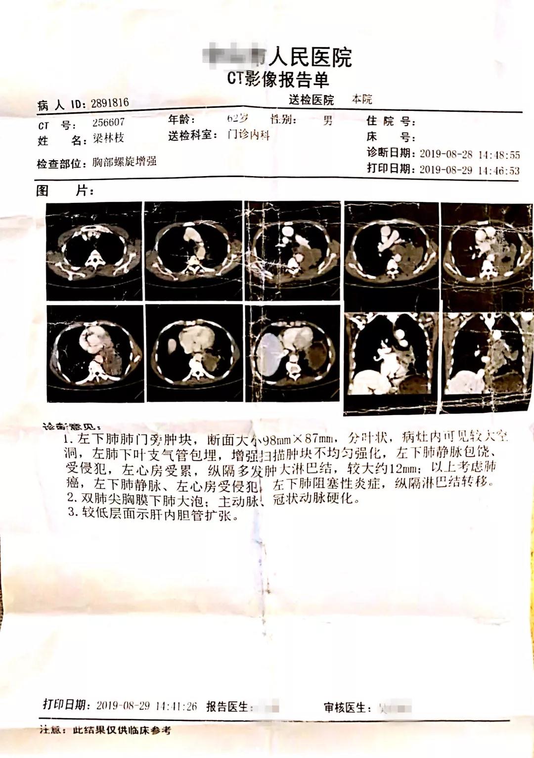 原始点调理肺癌晚期案例---感恩遇见 - 肺结核  肺腺癌  肺癌 - 佛山市愿天下无痛健康管理服务有限公司-原始点全球同学网