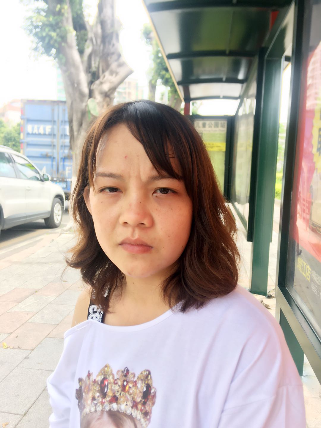 原始点调理牙痛脸肿案例 - 头颈  五官 - 佛山市愿天下无痛健康管理服务有限公司