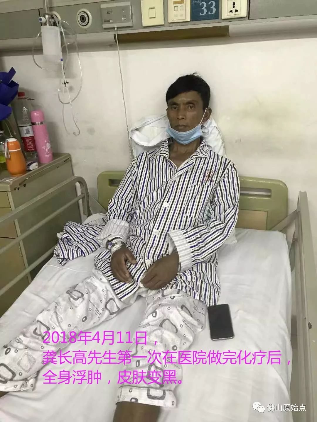 原始点调理浆细胞型巨大淋巴结增生病（CastIeman病）案例 - 身体  五脏六腑 - 佛山市愿天下无痛健康管理服务有限公司