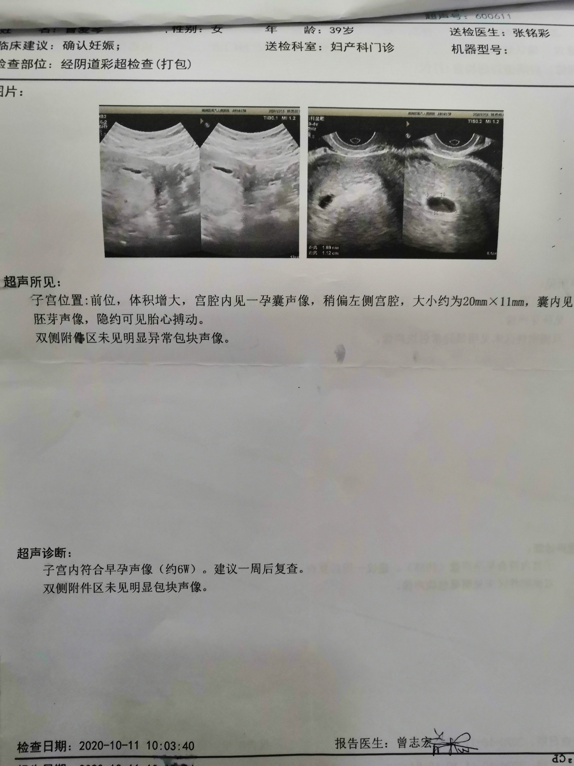 原始点调理胎死腹中案例 - 妇产   - 佛山市愿天下无痛健康管理服务有限公司