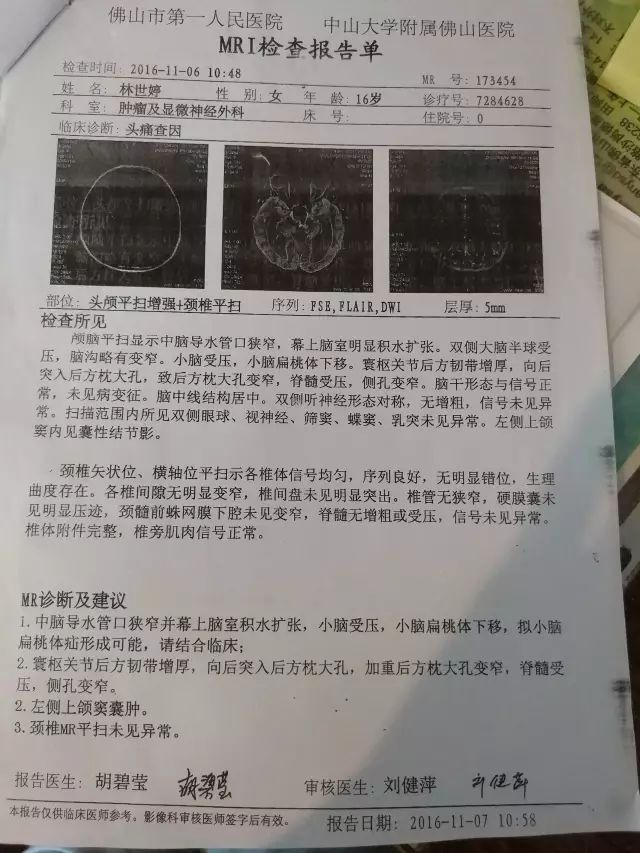 原始点调理中脑管口狭窄脑积水:65天,从黑暗到光明 - 头颈 五官 - 佛山市愿天下无痛健康管理服务有限公司-原始点全球同学网
