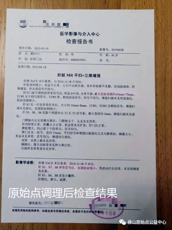 原始点调理肝癌四年后回访录：夏先生 - 肝硬化  肝腹水  肝癌 - 佛山市愿天下无痛健康管理服务有限公司