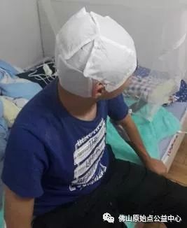 原始点调理九年史牛皮癣：二十天大变化 - 皮肤 - 佛山市愿天下无痛健康管理服务有限公司