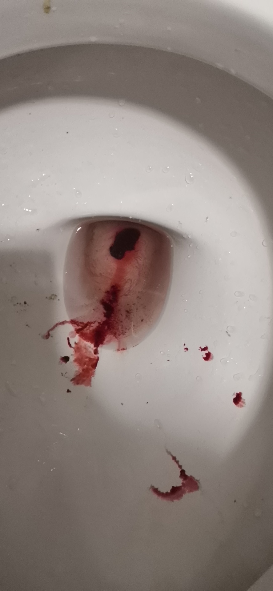 原始点调理胎死腹中案例 - 妇产   - 佛山市愿天下无痛健康管理服务有限公司