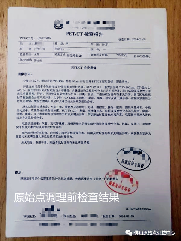 原始点调理肝癌四年后回访录：夏先生 - 肝硬化  肝腹水  肝癌 - 佛山市愿天下无痛健康管理服务有限公司