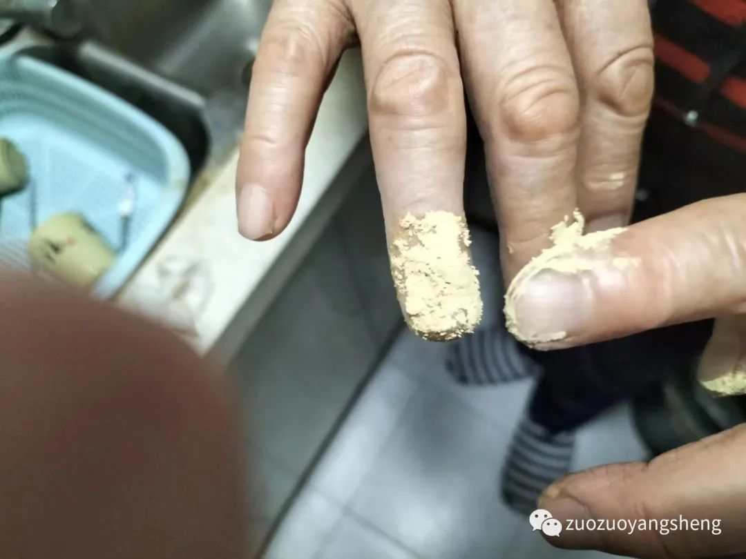 案例分享:原始点处理手指被夹伤血流不止的案例 案例分享:原始点处理手指被夹伤血流不止的案例