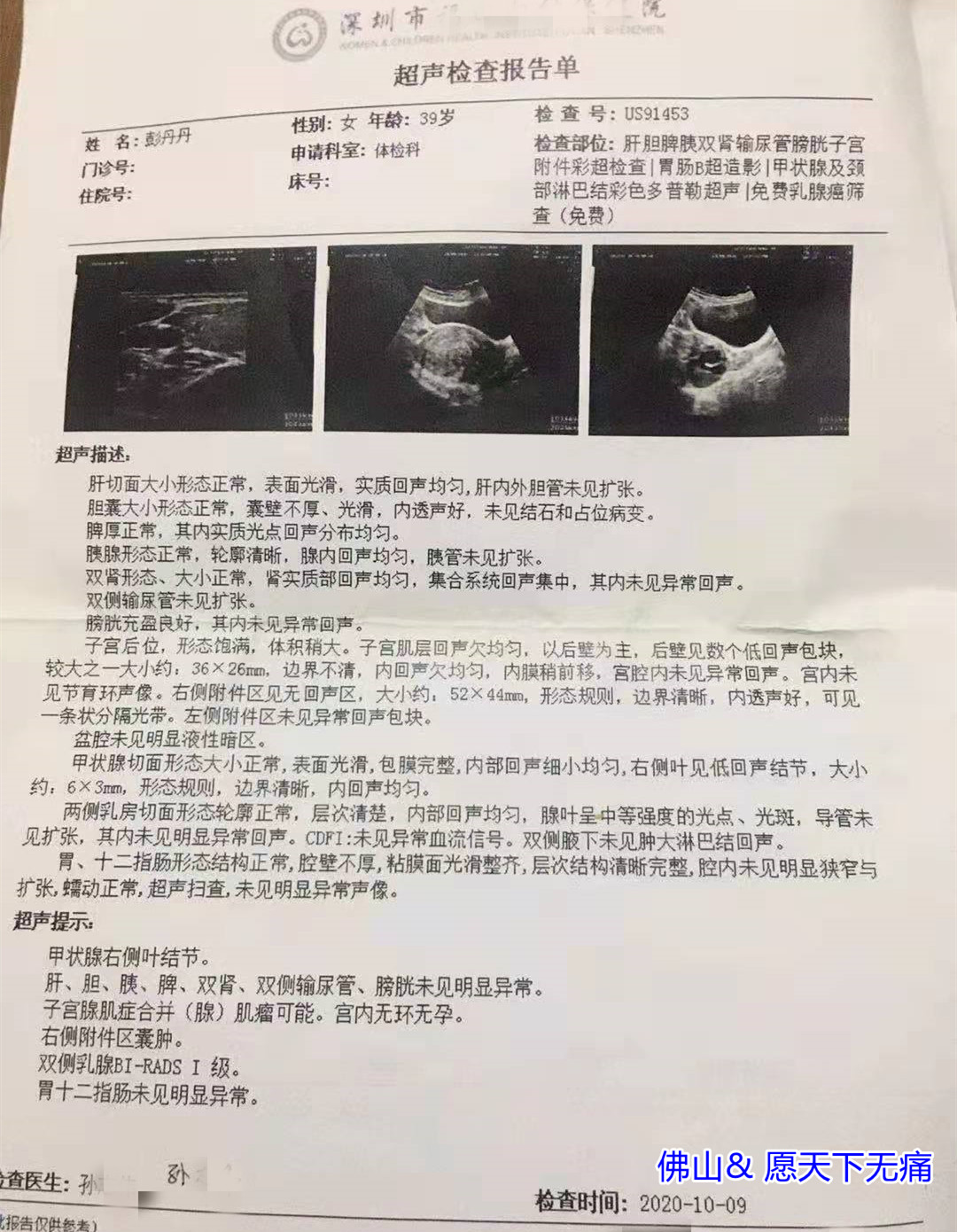 原始点调理子宫腺肌症 痛经案例 - 妇产   - 佛山愿天下无痛