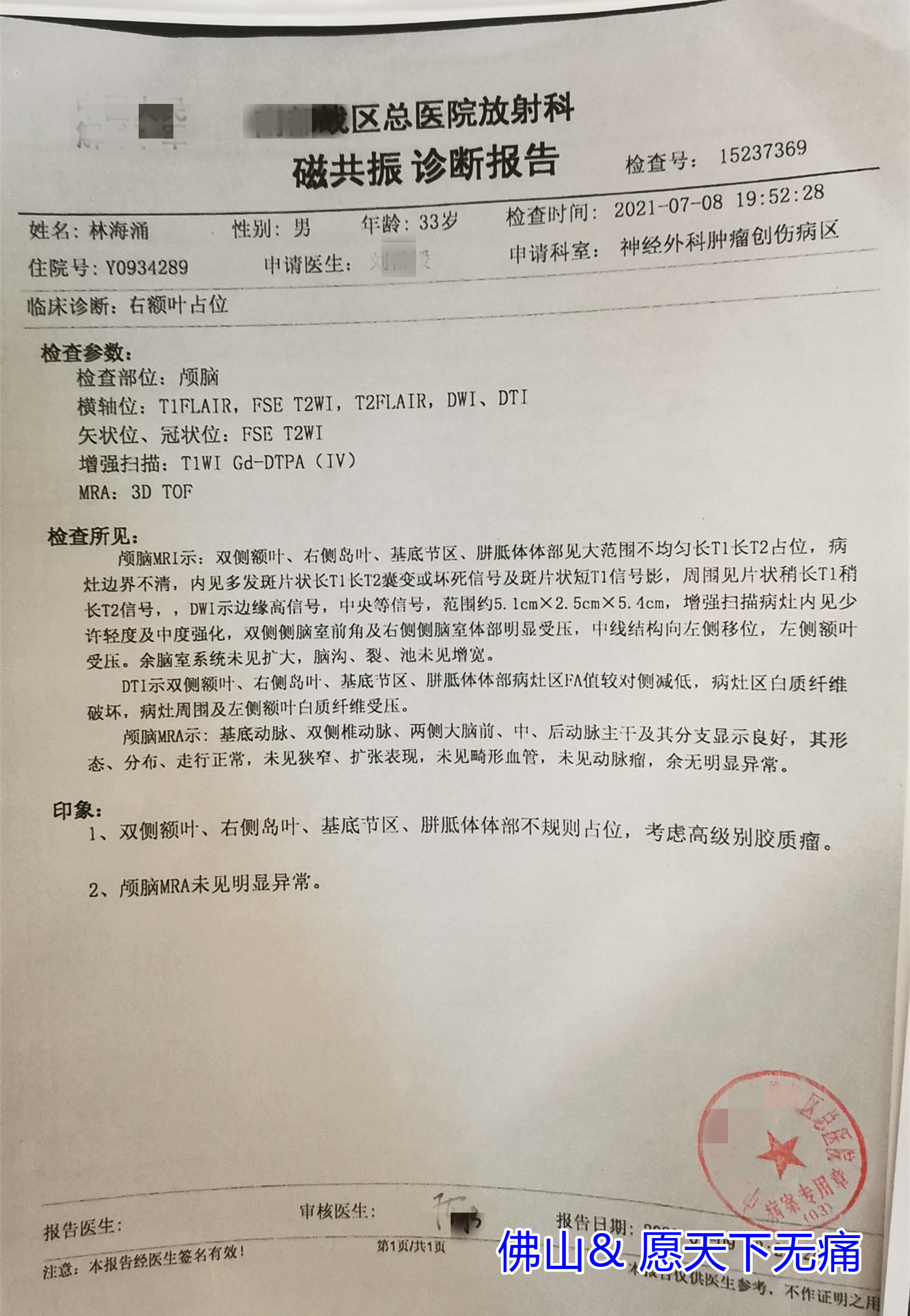 原始点调理脑胶质瘤开颅术后遗症案例 - 头颈  五官 - 佛山愿天下无痛