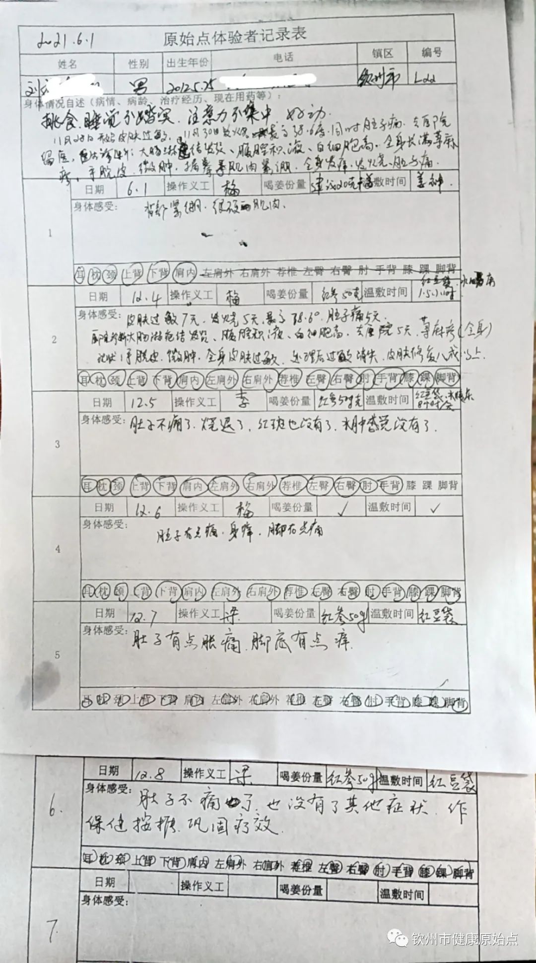 荨麻疹、发烧、肚子痛、手脱皮、手肿案例 荨麻疹、发烧、肚子痛、手脱皮、手肿案例