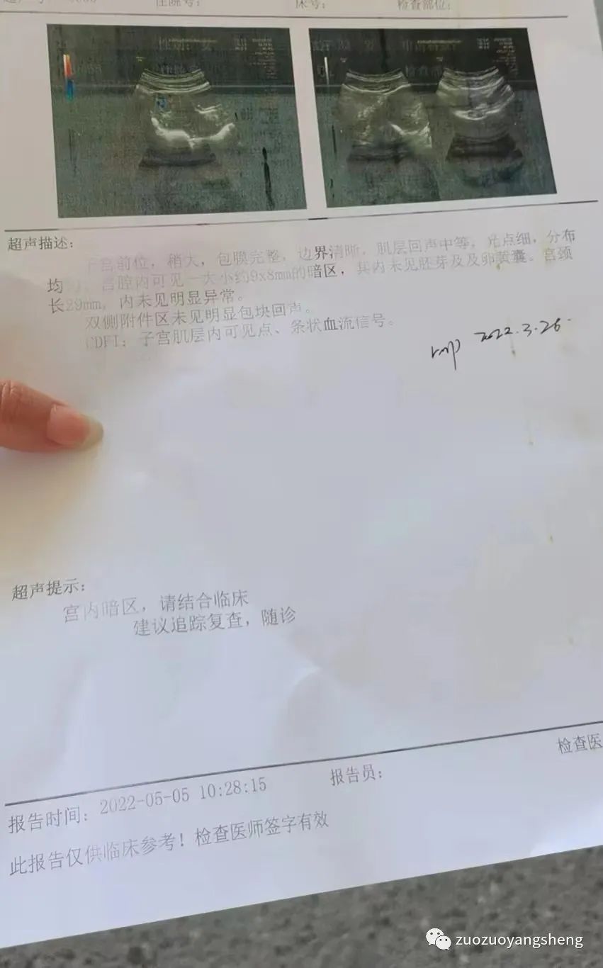 案例分享:原始点调理胎停的案例 案例分享:原始点调理胎停的案例