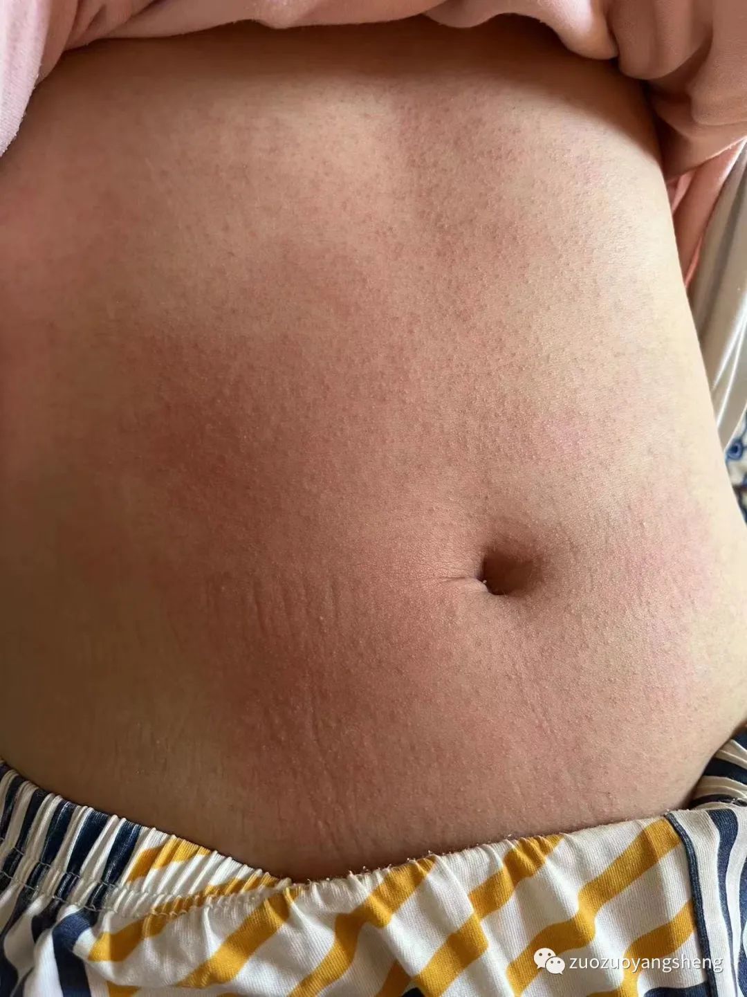 案例分享:原始点调理胎停的案例 案例分享:原始点调理胎停的案例