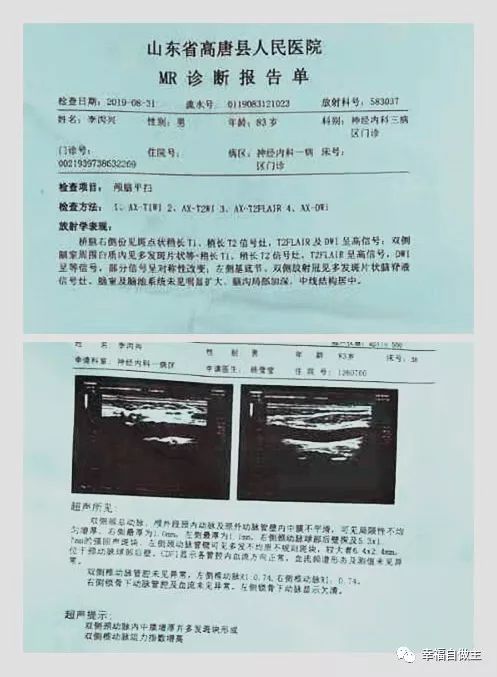 两位老人同一天脑梗，脑出血使用不同诊疗方法对比！
