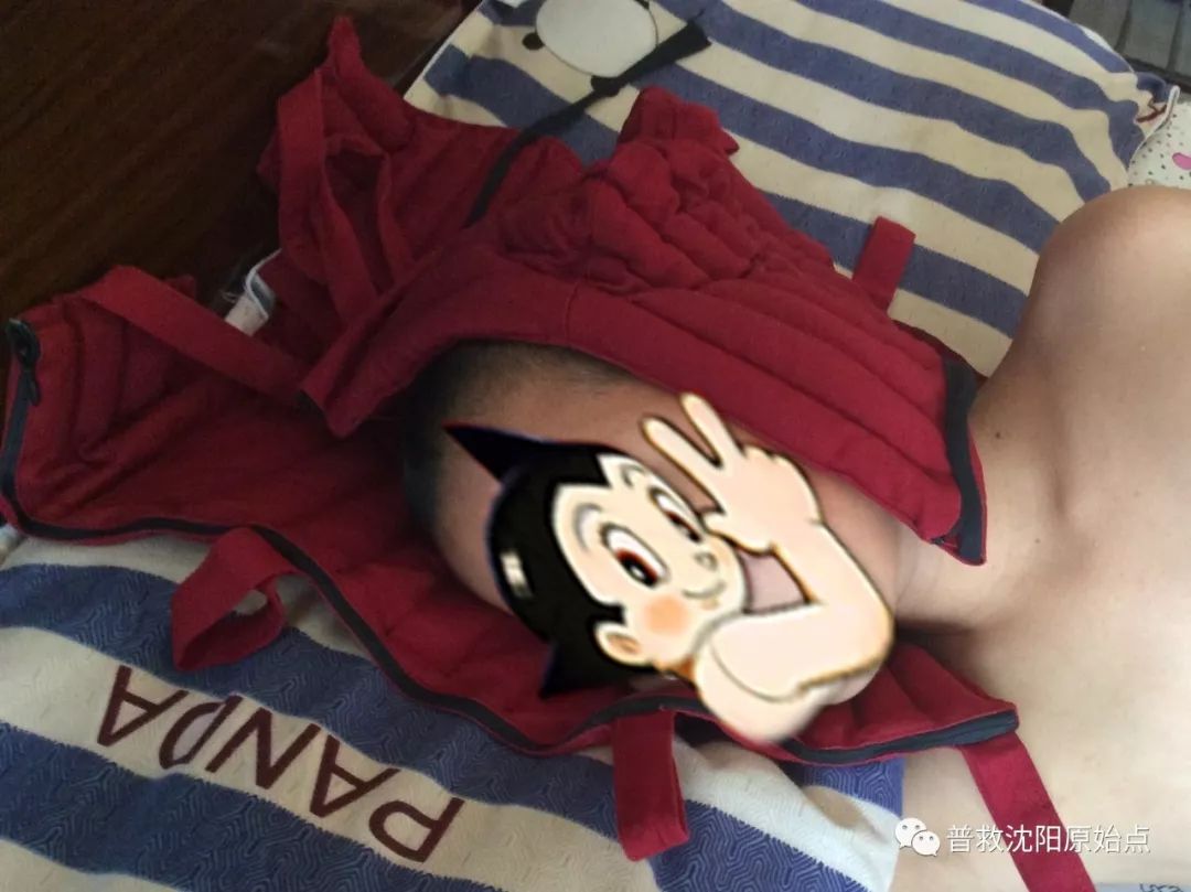 皮肤病案例（湿疹、水泡、破皮）