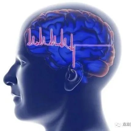 微问答20期：患有多年癫痫，发作起来很痛苦，请问还有什么好的办法？-原始点全球同学网