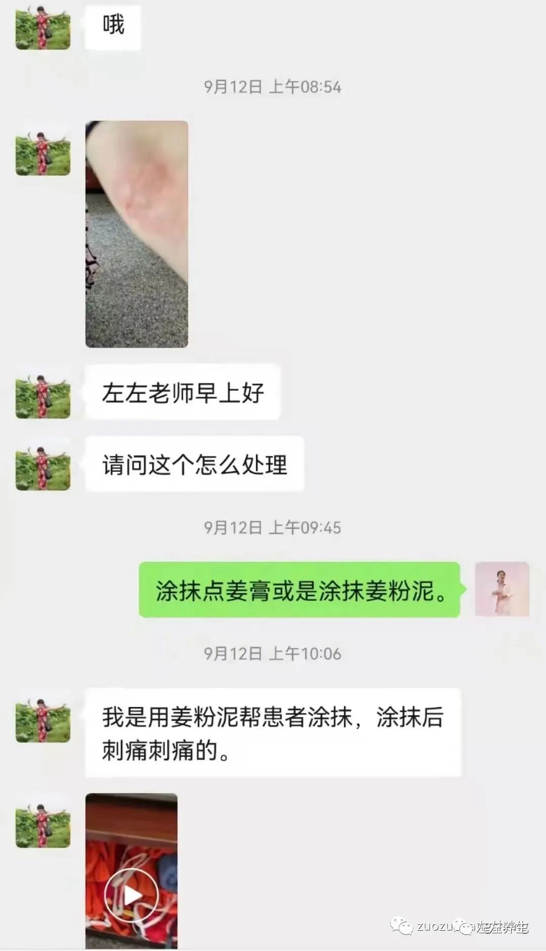 案例分享:小孩癫痫、脑发育不全、轻微自闭调理案例 案例分享:小孩癫痫、脑发育不全、轻微自闭调理案例