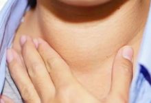 微问答23期：16岁小孩得了甲亢，对人爱理不理，经常发脾气-原始点全球同学网