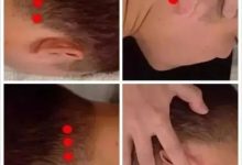 微问答14期:全身痒十几年了怎么调理?-原始点全球同学网