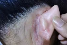 案例分享：不孕，小兒夜啼、奶水不足調理案例-原始點全球同學網