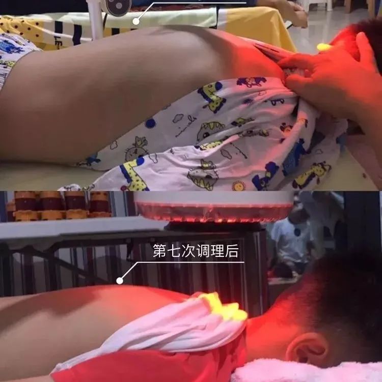 未雨绸缪，如何把握孩子长高季长高？-原始点全球同学网